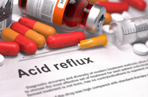 acid-reflux-prescription-medications