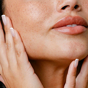Skin Health Isn’t Just About Skin